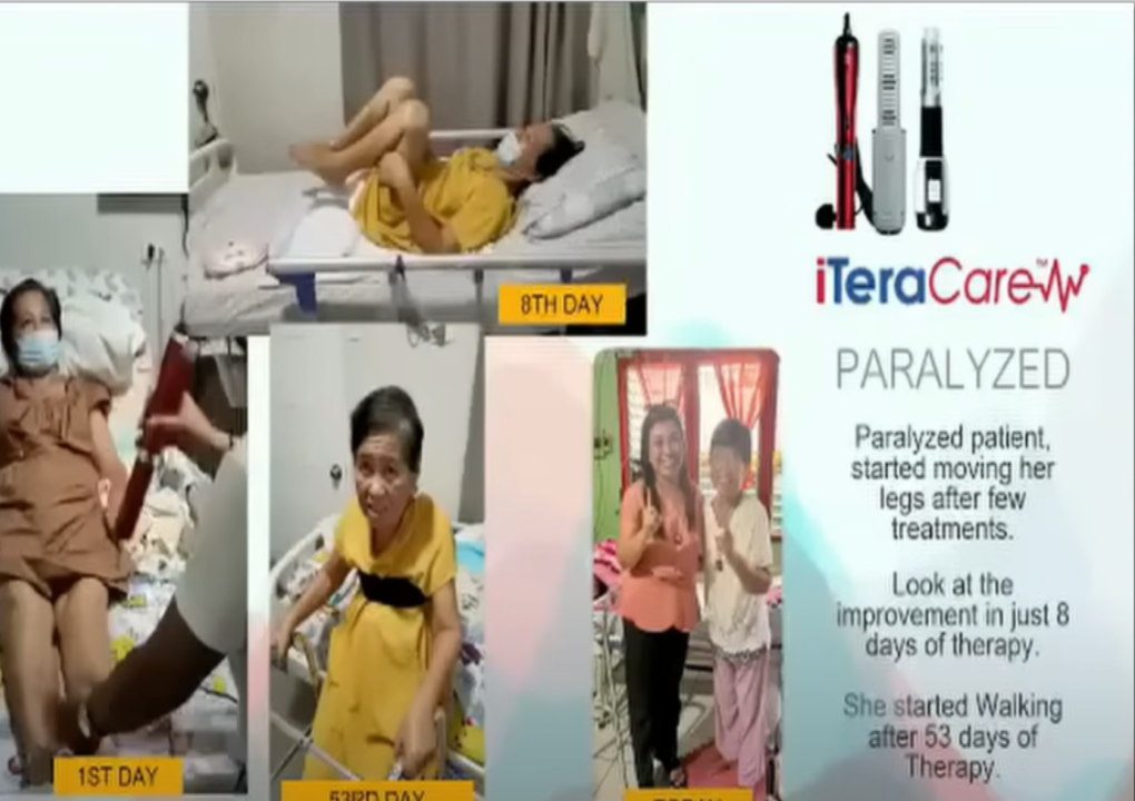 Paralyzed patient started moving her leg.