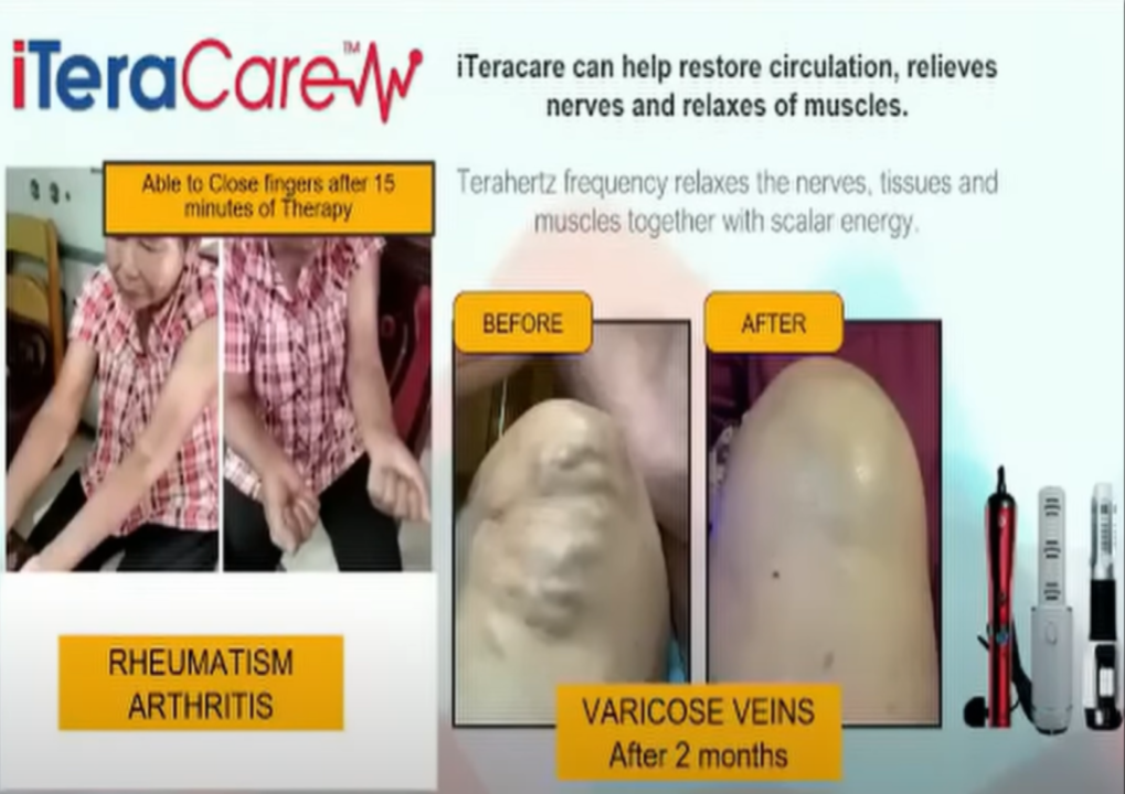 iTeraCare can help restore blood circulation, relieves nerves and relaxes muscles.